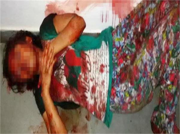 ಮಾರಣಾಂತಿಕವಾಗಿ ಹೊಡೆದರೂ ಯುವಕನನ್ನು ಕಚ್ಚಿ ಅತ್ಯಾಚಾರ ಯತ್ನವನ್ನು ವಿಫಲಗೊಳಿಸಿದ ವಿದ್ಯಾರ್ಥಿನಿ